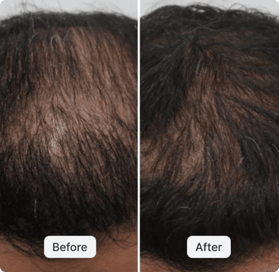before after image