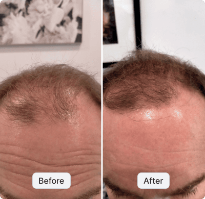before after image