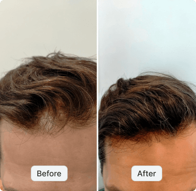 before after image