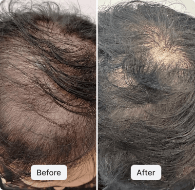 before after image